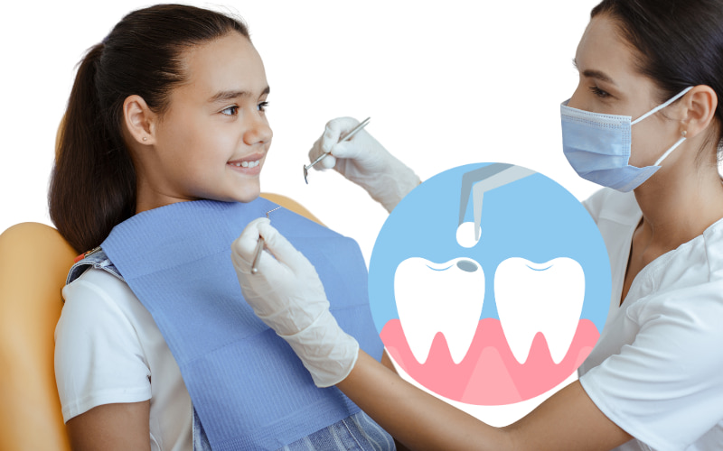 Răng đã trám hoàn toàn có thể trám lại được nếu miếng trám cũ bị hư hỏng