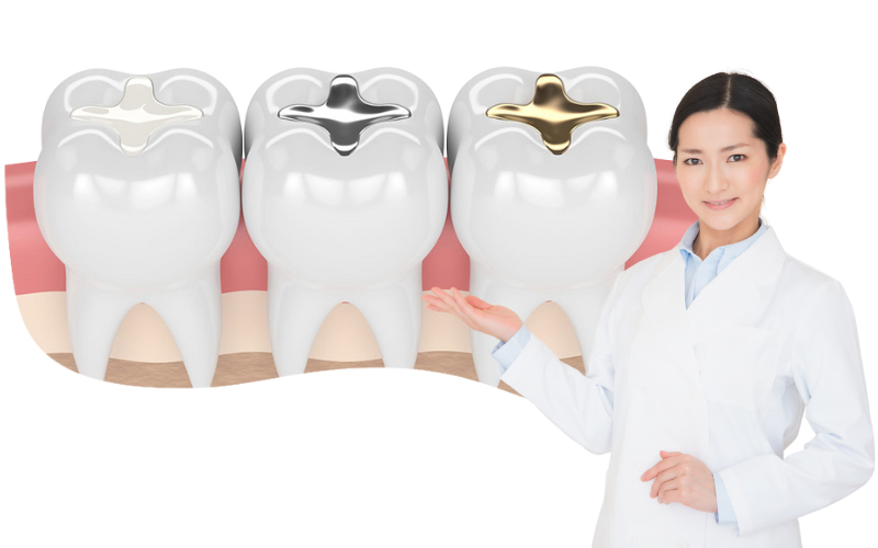 Trám răng hoàn toàn có thể bị đổi màu theo thời gian.