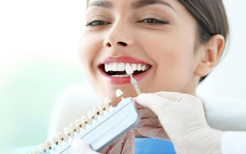 Trám răng khểnh là kỹ thuật nhanh chóng, ít xâm lấn và mang lại hiệu quả thẩm mỹ cao nếu được thực hiện bởi bác sĩ có tay nghề.