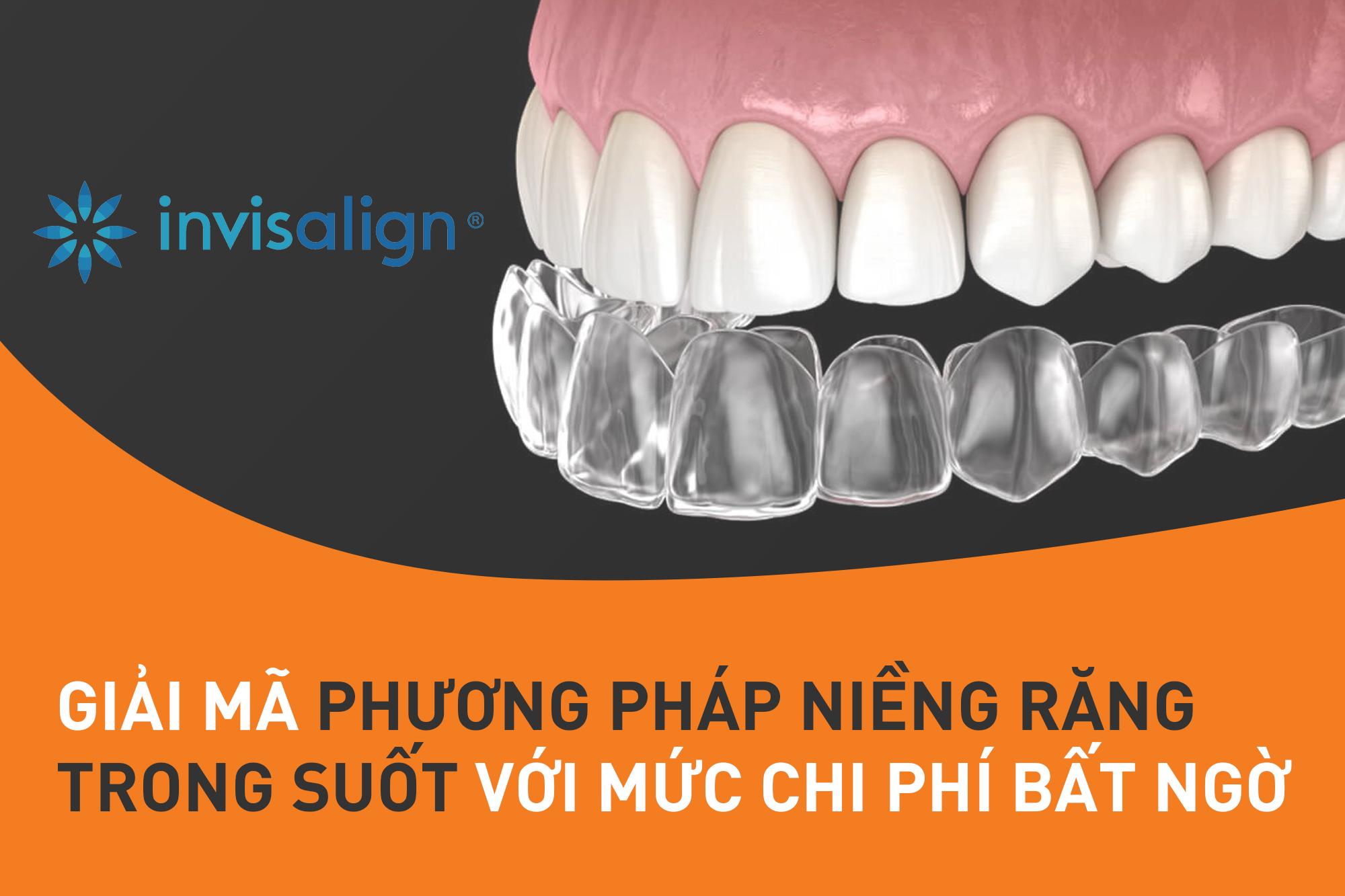Review kết quả niềng Invisalign