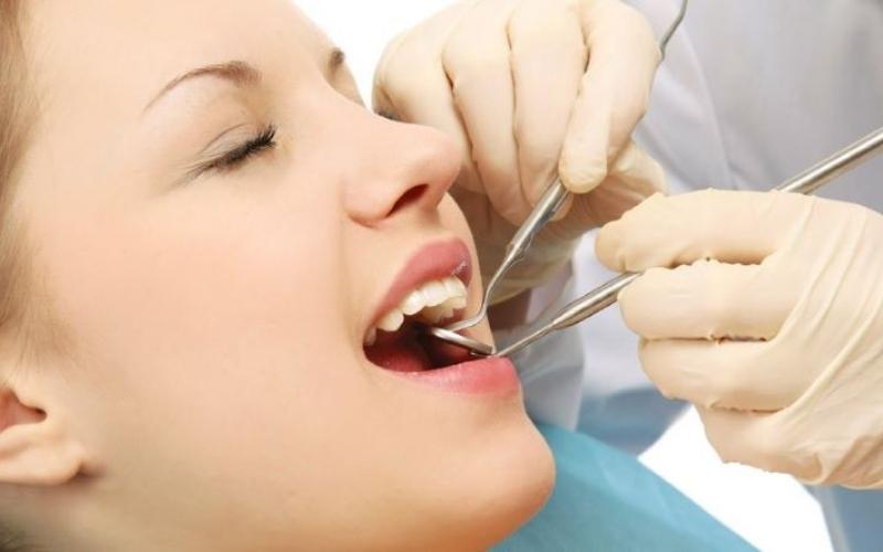 Nên đến nha khoa cạo vôi răng thường xuyên để ngừa áp xe răng