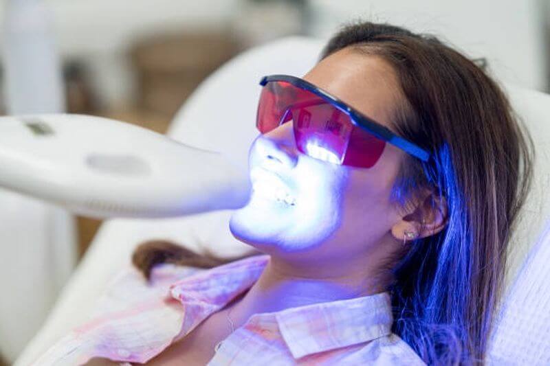 Tẩy trắng răng bằng công nghệ laser hiện đại mới mang lại hiệu quả vượt trội