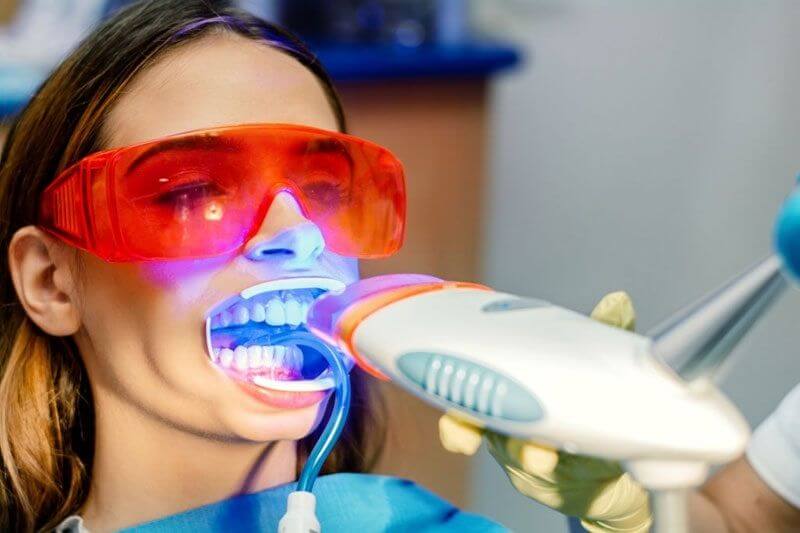 Tẩy trắng răng bằng công nghệ laser xanh mang lại hiệu quả cao