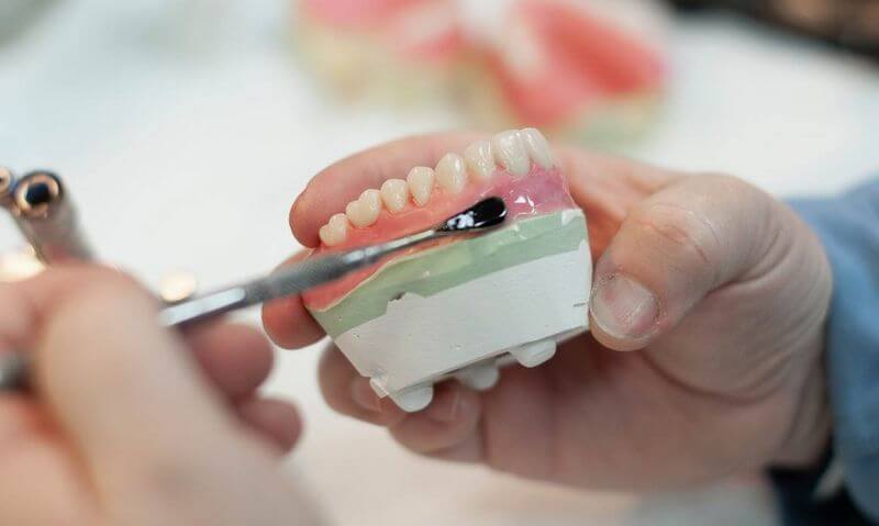 Mẫu răng sẽ được đem đến labo để sản xuất răng sứ