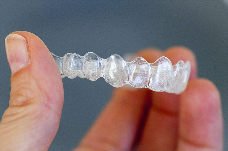 Niềng răng 3D Clear Aligner sử dụng hệ thống khay niềng bằng chất liệu nhựa trong suốt