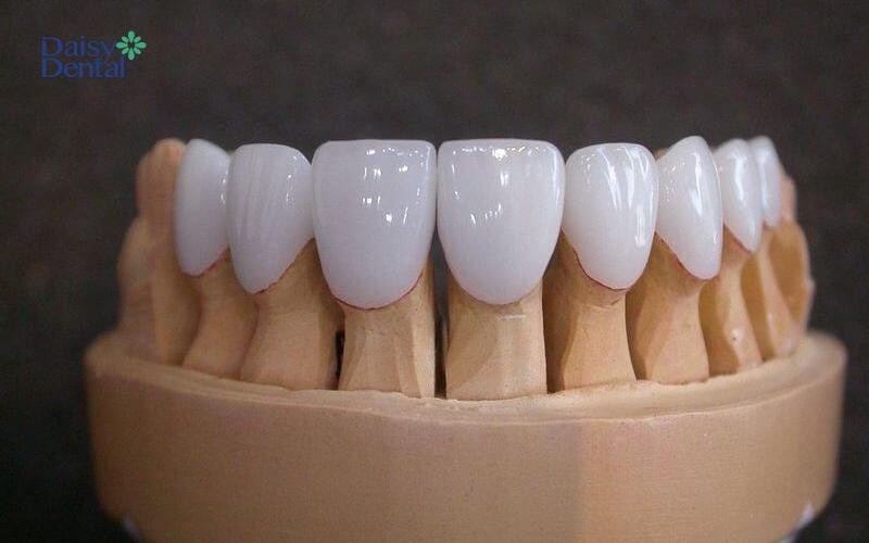 Sản phẩm răng sứ Titan Berlin có nguồn gốc từ Mỹ và Đức