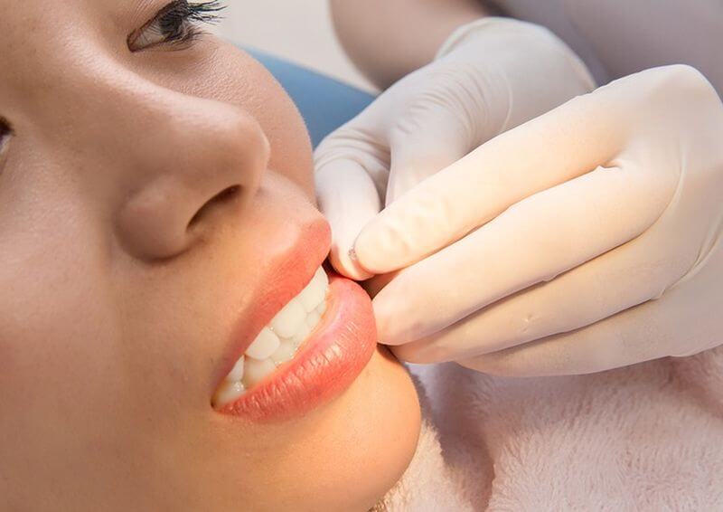 Đính đá không khoan lỗ giúp răng không bị ảnh hưởng về hình dạng và đảm bảo sức khỏe răng miệng