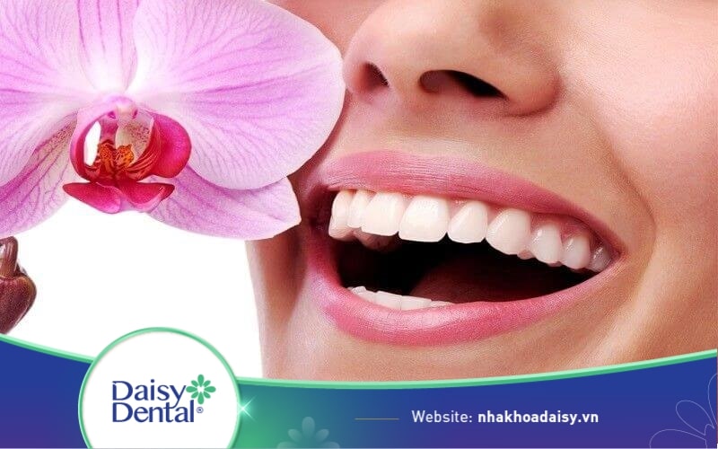 Địa chỉ bọc răng sứ ở Đà Lạt
