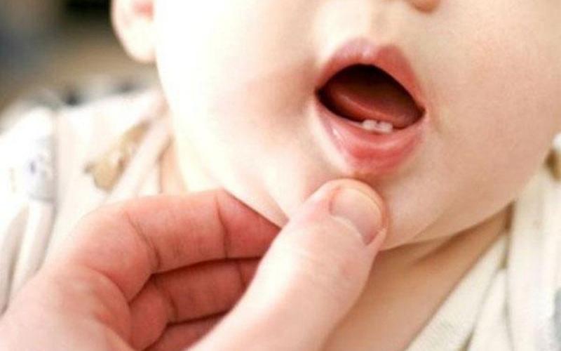 Giai đoạn 6 tháng tuổi trẻ bắt đầu mọc những chiếc răng sữa đầu tiên