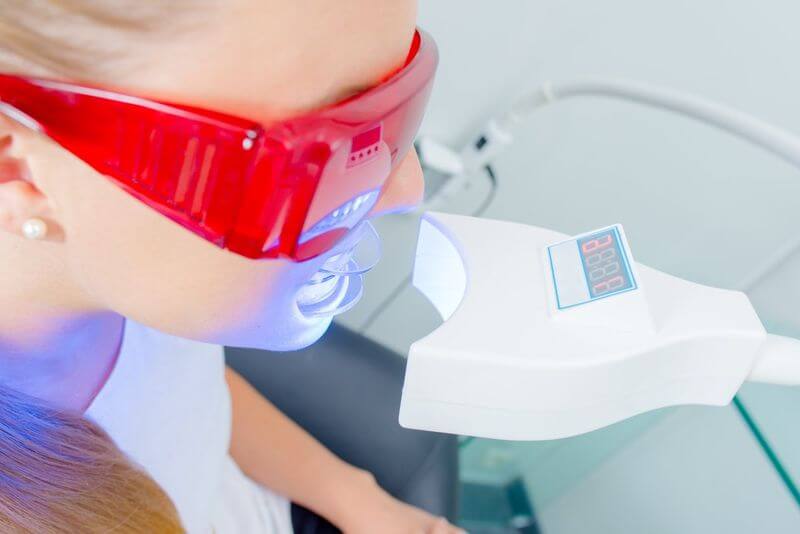 Các chuyên gia khuyến cáo nên tẩy trắng răng bằng công nghệ Laser