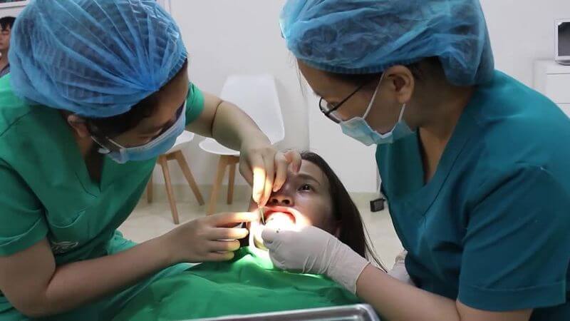 Trường hợp răng quá khấp khểnh thì bác sĩ sẽ sử dụng minivis để neo giữ cố định