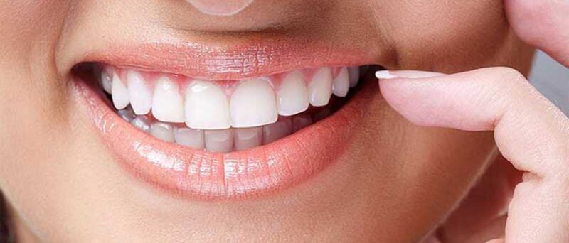 Tẩy trắng răng bằng công nghệ cao ít tác dụng phụ