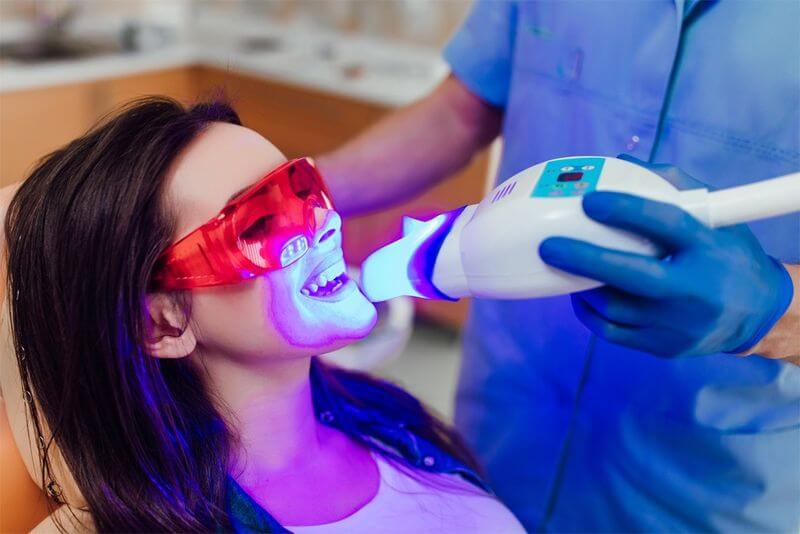 Phương pháp tẩy trắng răng laser whitening sử dụng ánh sáng màu xanh đậm