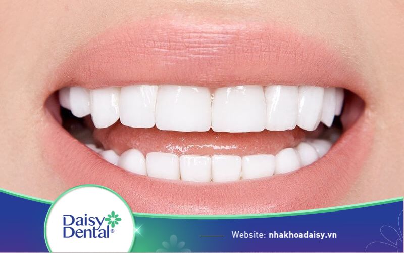 Trồng răng Implant ở Đồng Nai