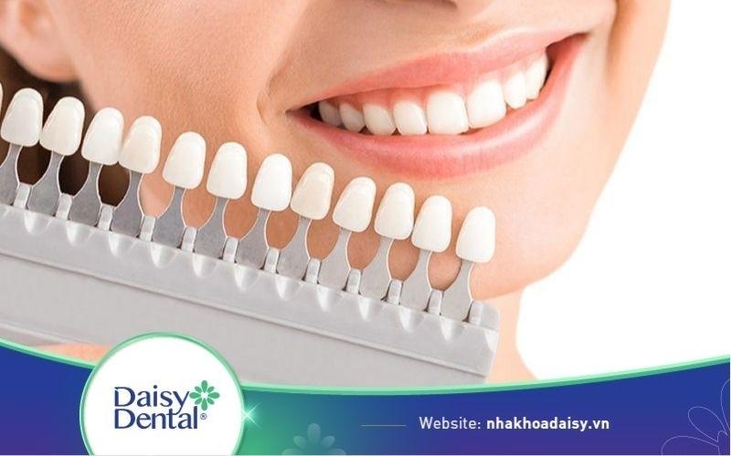 Bọc răng sứ có hại gì không
