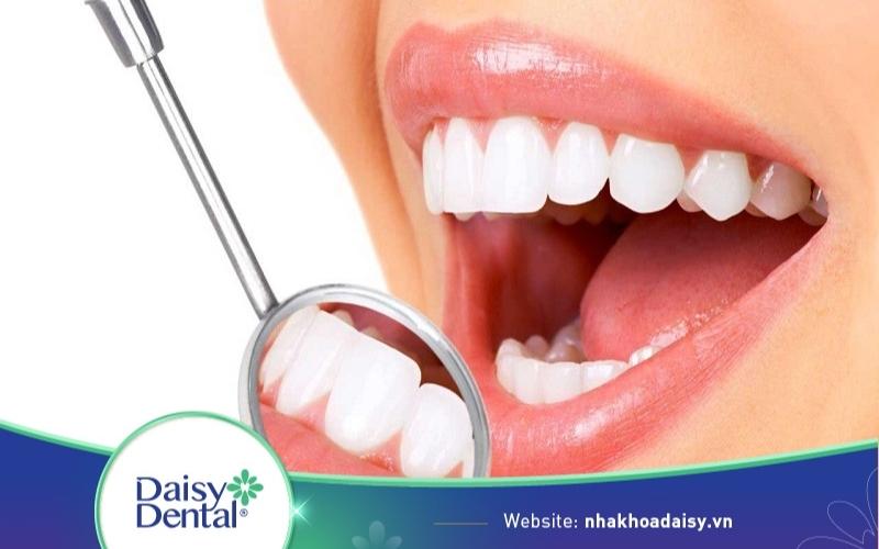 Bọc răng sứ có bền không
