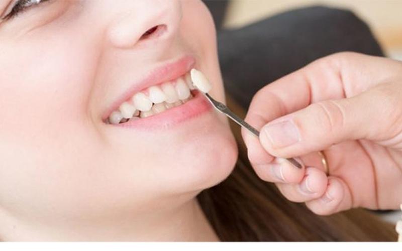 Mài răng xong bạn nên tiến hành bọc sứ để bảo vệ răng thật