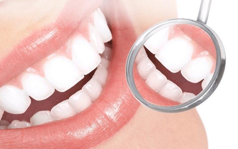 Bọc răng sứ chỉ phù hợp với răng hô, móm, lệch lạc nhẹ và răng bị xỉn màu