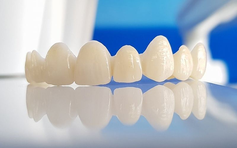 Răng sứ kém chất lượng gây ra tình trạng hôi miệng sau khi bọc sứ