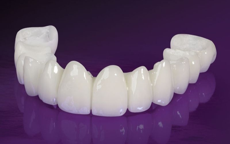 Nhóm mão răng sứ toàn sứ có độ bền chắc cao hơn răng sứ kim loại