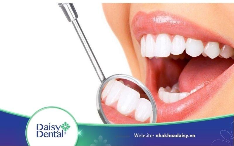 Nhược điểm của bọc răng sứ
