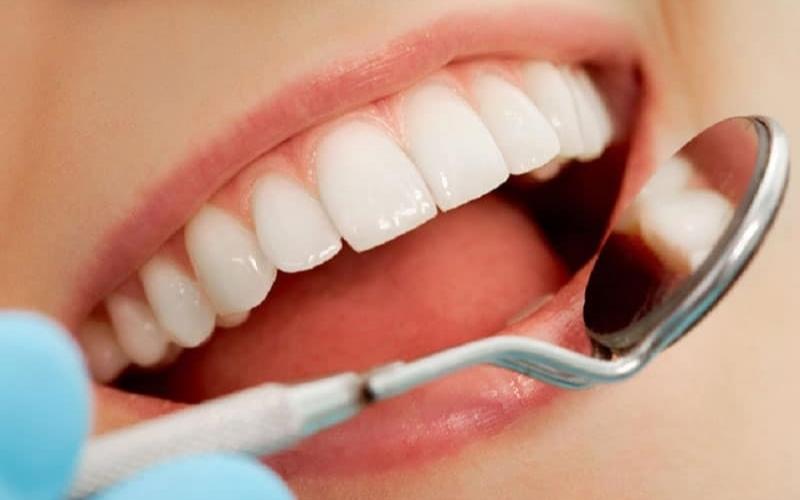 Những biện pháp bảo quản răng sứ góp phần gia tăng tuổi thọ của vật liệu này