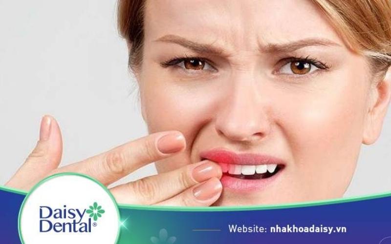 Răng Bọc Sứ Bị Chảy Máu