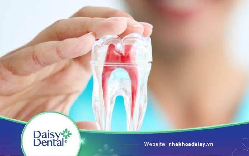 Bọc răng sứ có cần lấy tủy không