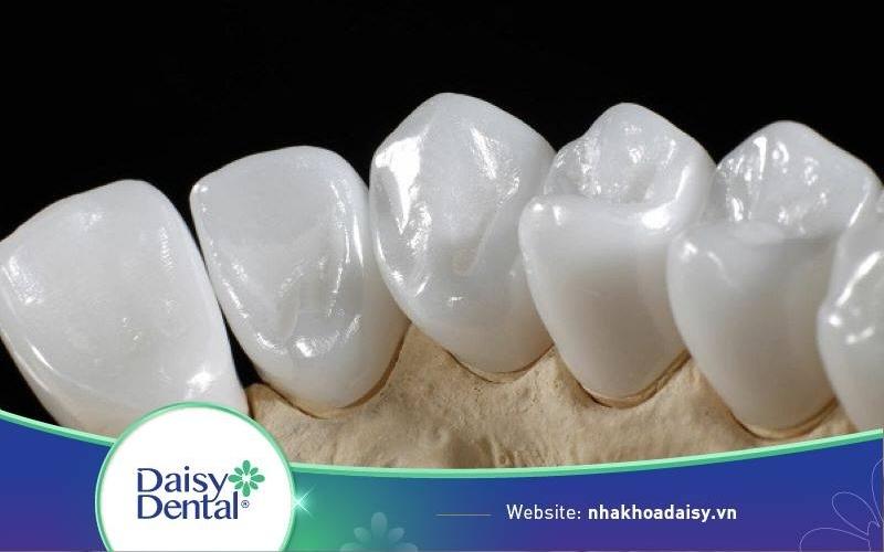 Giá răng sứ zirconia
