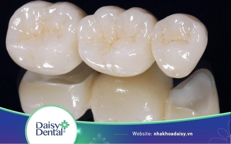 Cách bảo quản răng sứ Titan