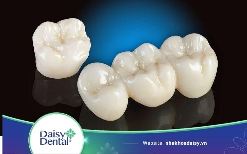 Độ bền của răng sứ cercon