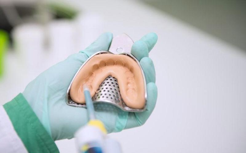 Kỹ thuật viên lấy dấu răng để chế tác mẫu răng sứ phù hợp với răng thật