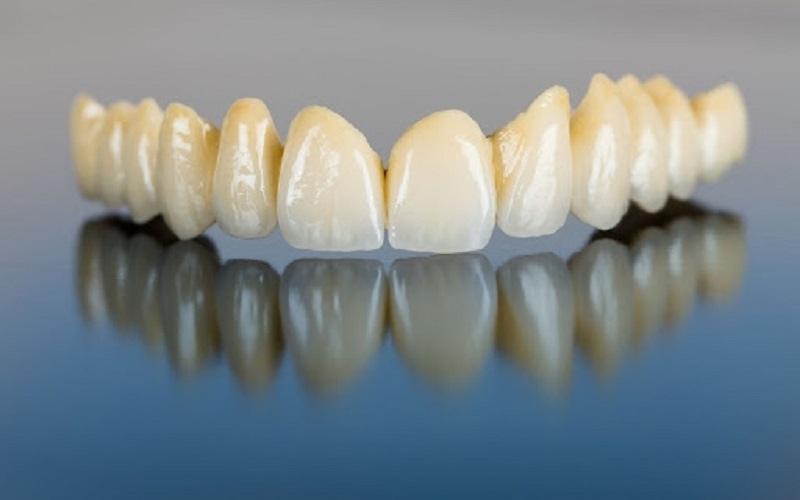 Răng toàn sứ được làm bằng 100% sứ nguyên chất
