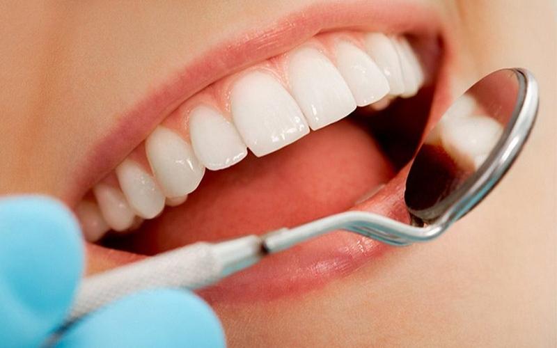 Tình trạng răng miệng ảnh hưởng chi phí bọc răng sứ nguyên hàm