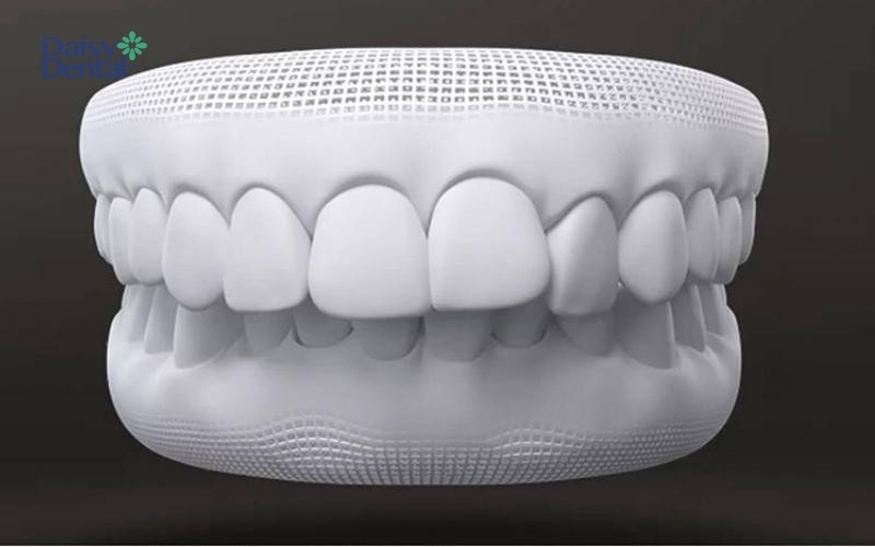 Công nghệ Nano Shining 5s giúp răng có hình thể đẹp, chuẩn tỷ lệ “vàng” với cơ chế tự động hóa