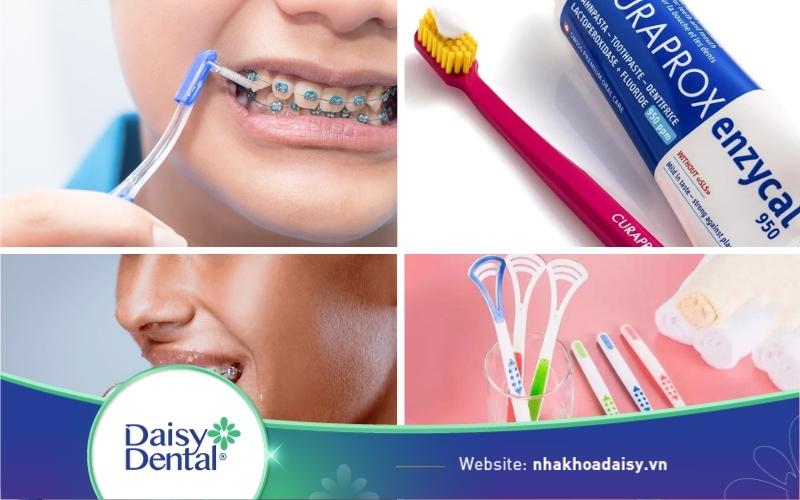 Bộ dụng cụ vệ sinh răng niềng