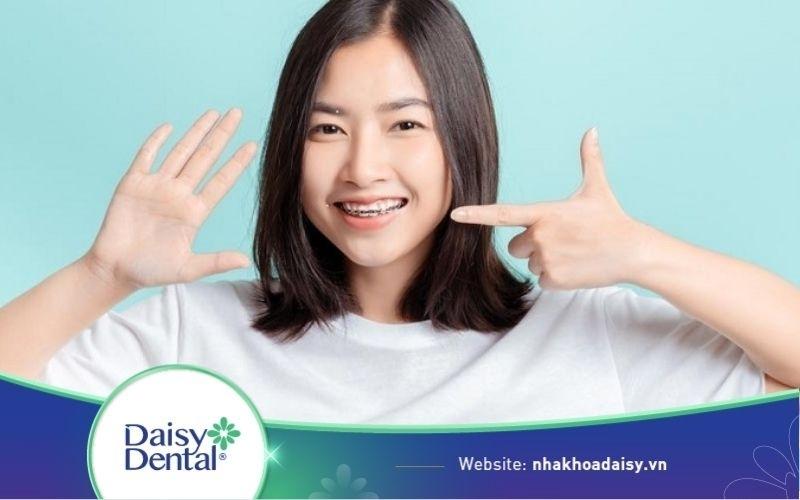 Các loại mắc cài niềng răng