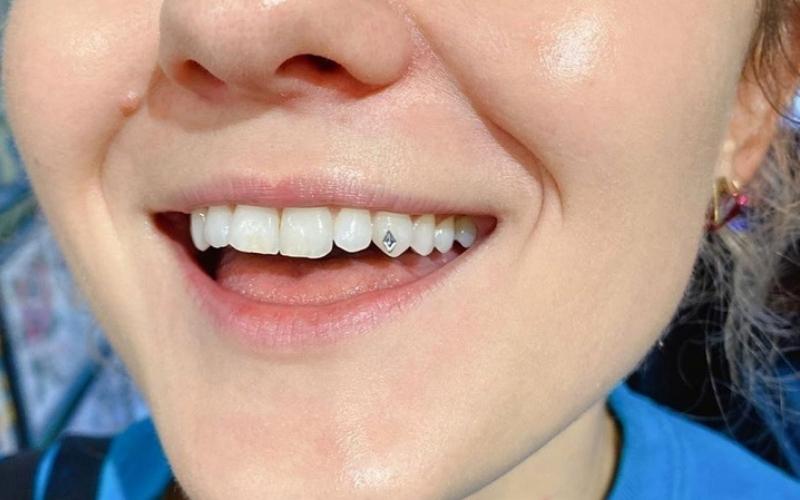 Đá nha khoa có bề mặt phẳng, mài nhẵn nên vẻ đẹp thẩm mỹ cao, không ảnh hưởng đến cấu trúc răng miệng