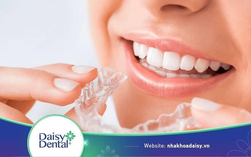 Niềng răng trong suốt có đau không