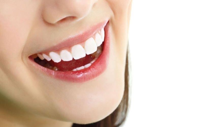 Phủ răng sứ là một bước tiến vượt bậc của nha khoa thẩm mỹ
