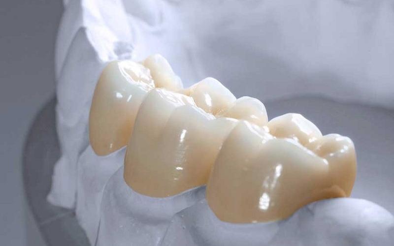 Răng DDBIO có tính an toàn sinh học cao nhờ làm từ sứ Zirconia nguyên khối