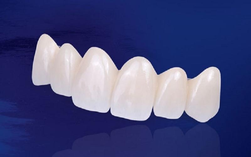Răng sứ DDBIO là chất liệu có nguồn gốc xuất xứ từ đất nước Đức xinh đẹp