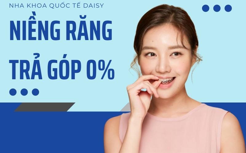 Niềng răng trả góp 0% lãi suất tại Nha Trang