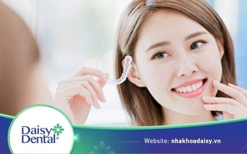 Niềng răng trong suốt bao lâu