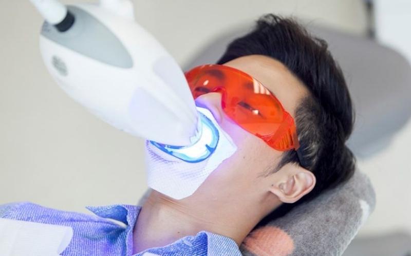 Sử dụng tia laser để tẩy trắng