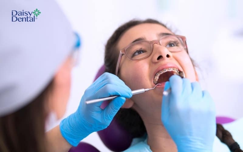 Sở hữu hàm răng đều đặn khi niềng răng tại nha khoa Nguyễn Đắc Cật
