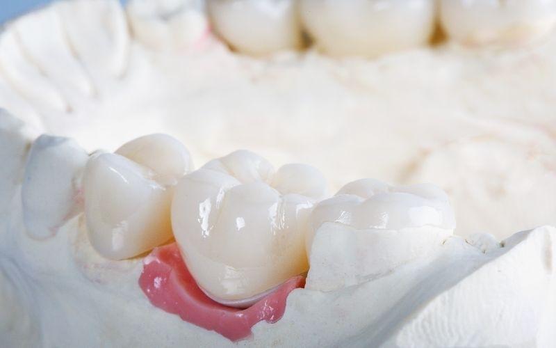 Nướu răng sưng đỏ là tình trạng vùng sinh học lợi bị tổn thương