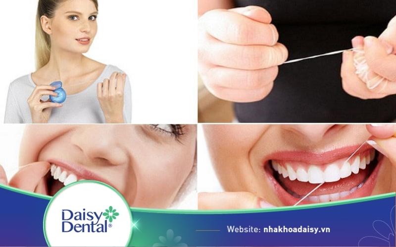 Cách ngừa sâu răng