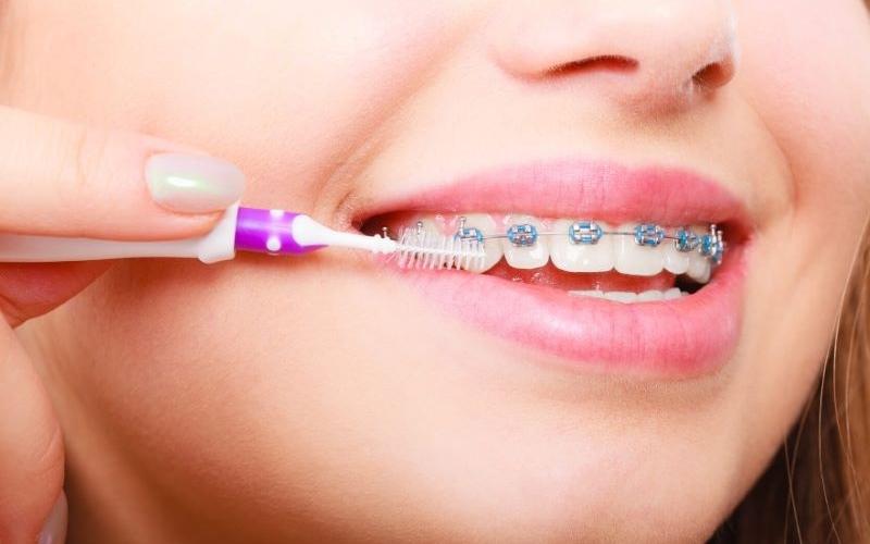 Xây dựng lại thói quen chăm sóc răng miệng để hạn chế tình trạng hô sau khi niềng