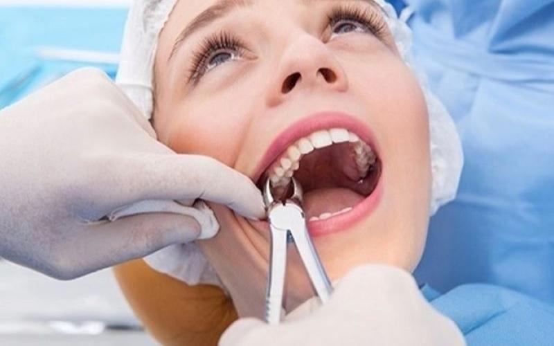 Tùy vào tinh trạng răng miệng của người bệnh, bác sĩ sẽ chỉ định nhổ răng số 6